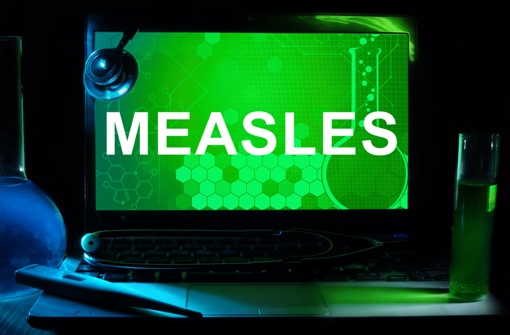 חצבת (Measles)